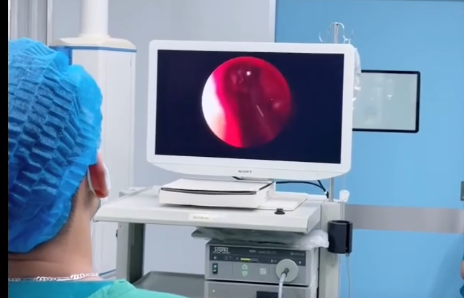 PHẪU THUẬT NỘI SOI MŨI XOANG: GIẢI PHÁP ĐIỀU TRỊ VIÊM XOANG KÉO DÀI, TÁI PHÁT NHIỀU LẦN